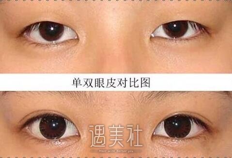 浙一整形美容科