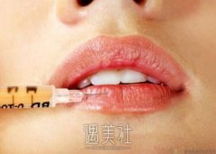 玻尿酸丰唇整形术费用高吗?大概多少钱？ width=