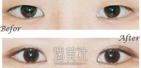 李光琴