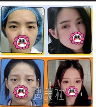 周长兵