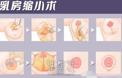 栗勇,缩胸