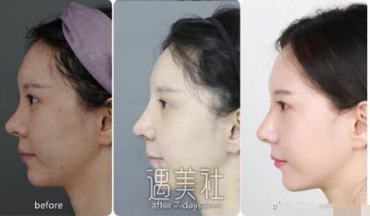 贾德渊,倪云志