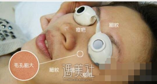 鼓楼医院,点阵激光