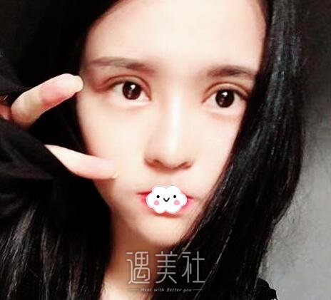 刘风卓,眼整形修复