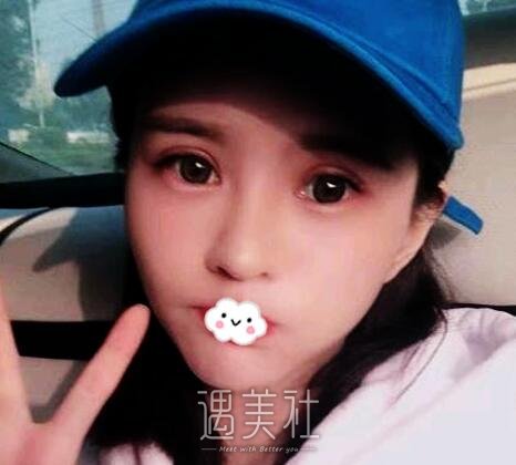刘风卓,眼整形修复