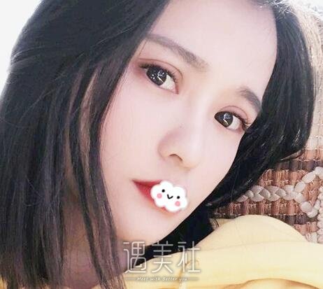 刘风卓,眼整形修复