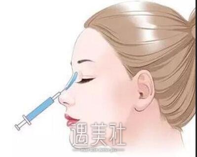 玻尿酸隆鼻