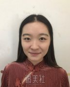 霍孟华光子嫩肤怎么样 案例前后对比? width=