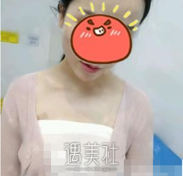 栗勇,丰胸