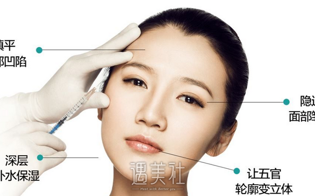 北京,玉之光,玻尿酸注射