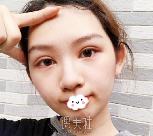 崔永言