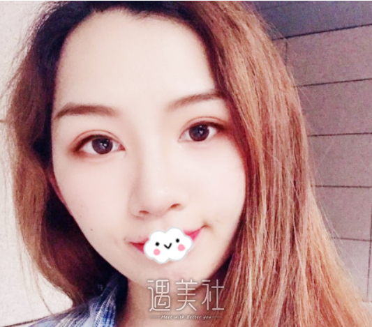 崔永言