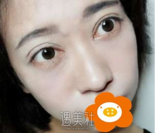祁佐良