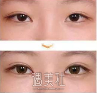 宁夏,华美