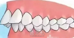 张富强正牙手术失败的案例有吗 width=