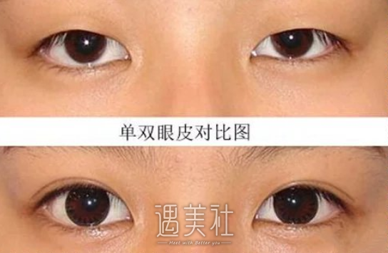 沈阳,杏林,张莹莹