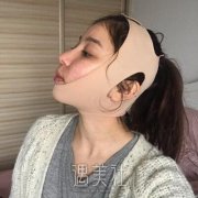 八大处杨斌医生有失败案例吗?真实下颌角整形案例一览~ width=