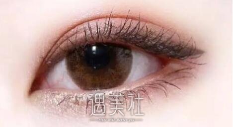 石家庄张卓男做双眼皮价格