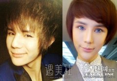 马里山整容前的样子|马里山整容前后差异大吗？ width=