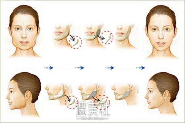 改脸型张笑天免费预约靠谱吗？一起来揭秘～