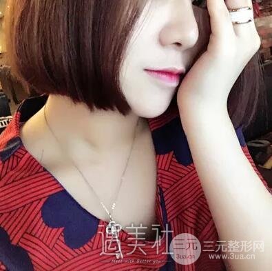 鼻头缩小手术对比图