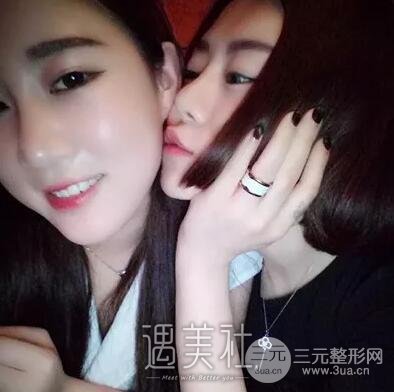 鼻头缩小手术对比图