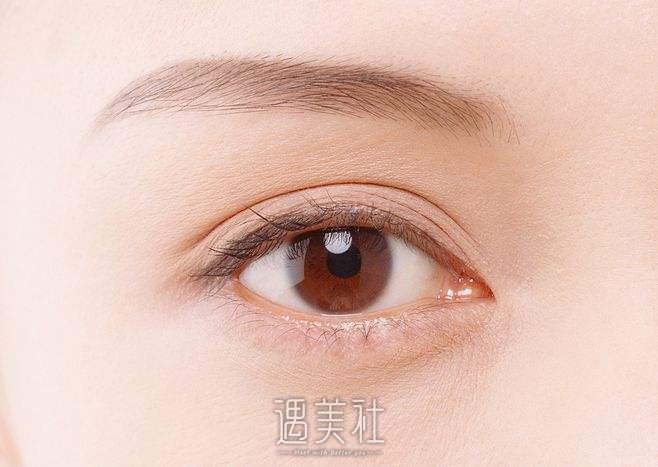 汕头双眼皮修复价格大概多少钱？