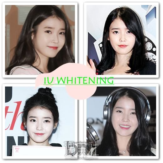 韩国明星都打美白吗？韩国明星打美白普遍吗？