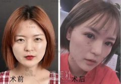 整1次就美的关键是？四川华美紫馨医美告诉你！ width=
