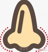 鼻子做成什么样才好看，一篇务实的鼻修复参考 width=