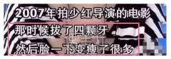 整牙能“换脸”，久一点又有什么关系！ width=