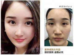 CS组合对一个人的改变有多大？颐正案例告诉你... width=