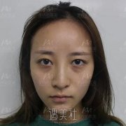 做错这4件事，你眼袋会更大更严重，注意避雷 width=