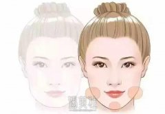 “黑心”美容院 注射化妆品隆下巴 width=