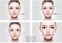 大脸妹有救啦!多种瘦脸法任你选 width=