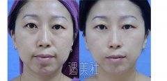 钢管舞奶奶整容似姐姐 南京街头秀舞技 width=