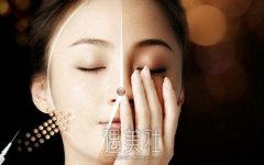 剩女较应该选择的五大微整形项目 width=