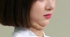 吸脂、激光溶脂、埋线提升 低头族的双下巴终于有救了! width=