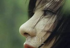 硅胶假体隆鼻可以用手捏吗? width=