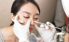 硅胶隆鼻 如何让你变高鼻 width=
