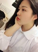 假体隆鼻 改良不的鼻型 width=