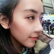 假体隆鼻术后鼻子发红怎么办? width=