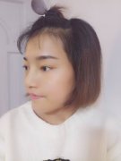假体隆鼻术后如何避免假体下滑? width=