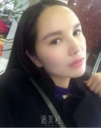 假体隆鼻果持久吗? width=