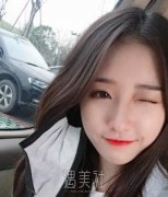 假体隆鼻要多少钱? width=