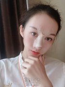 隆鼻假体取出后鼻子自然吗? width=