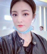 辛容镐院长：假体隆鼻提升你的气质 width=