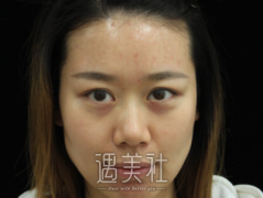 复合彩光嫩肤要多少钱？价格表2020新鲜正式发布~ width=