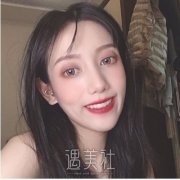 龅牙矫正后会漂亮吗？快来看看我的果成功了嘛？ width=