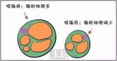 网传吸脂1斤会反弹5斤？真的吗？ width=